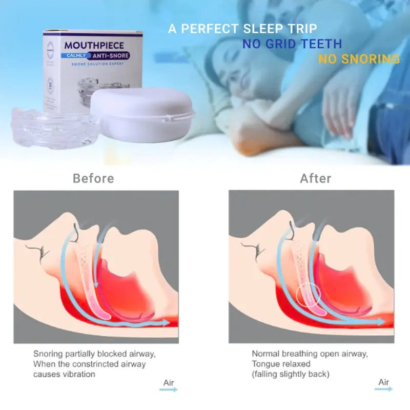 Calmly MouthPeace Guard Anti-Snore Calmly