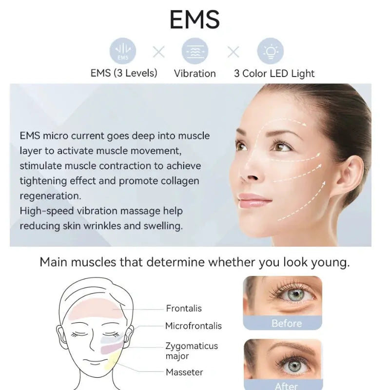 Calmly Anlan EMS Facial Pro Calmly